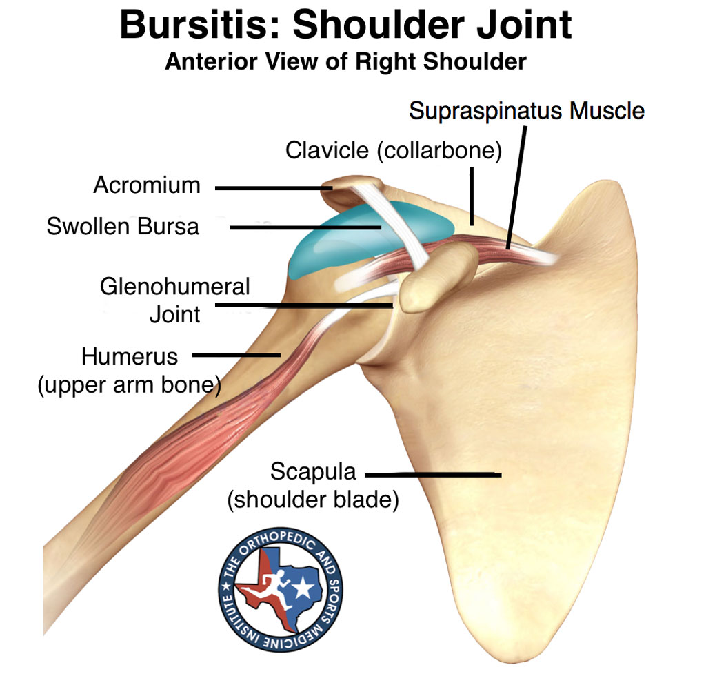 bursitis-shoulder-joint.jpg