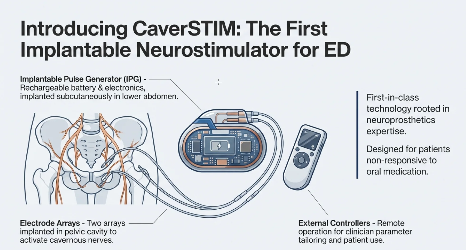 caverstim for ed.webp