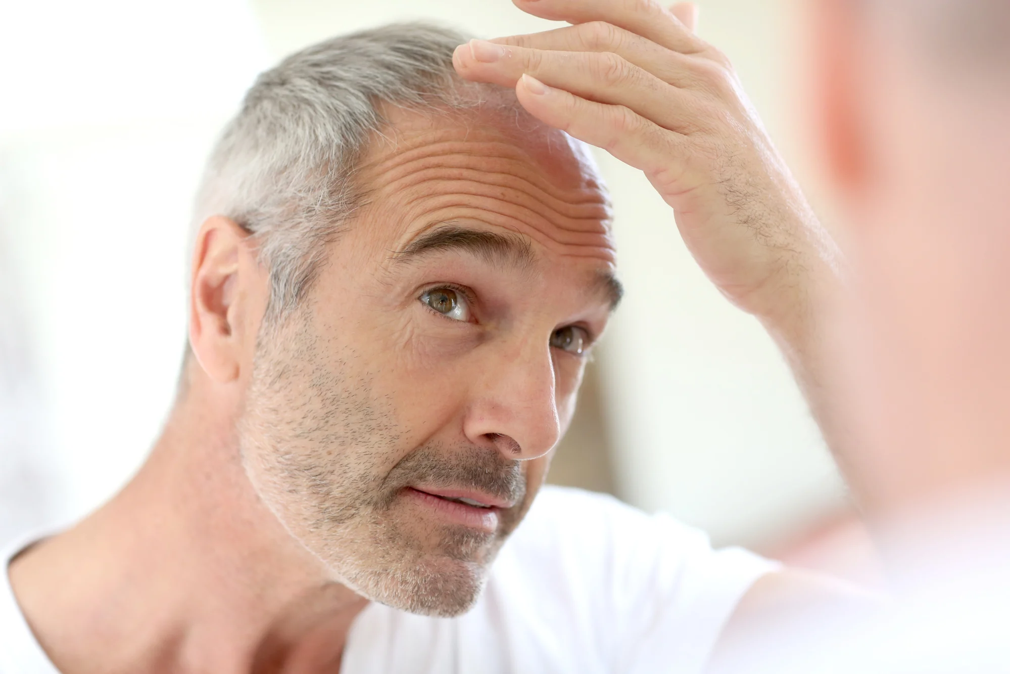 hair loss mature man.jpg