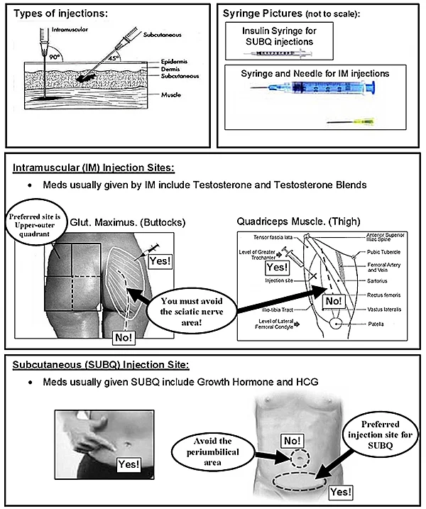 injection sites description.webp