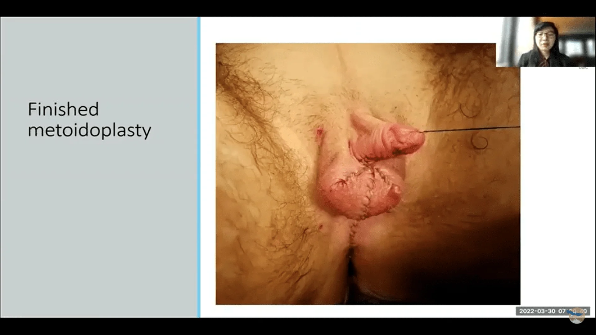 Screenshot (13353).webp