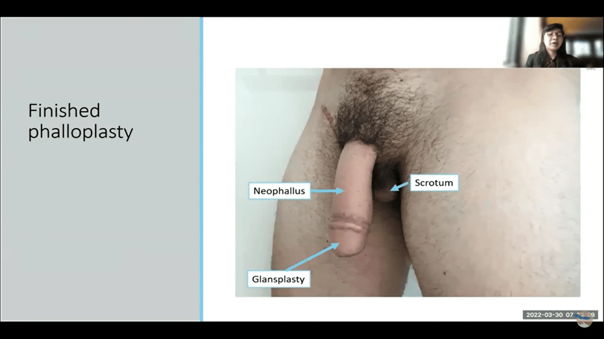 Screenshot (13357).webp
