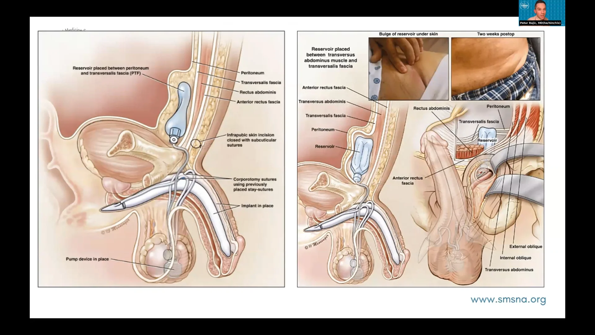 Screenshot (29919).webp