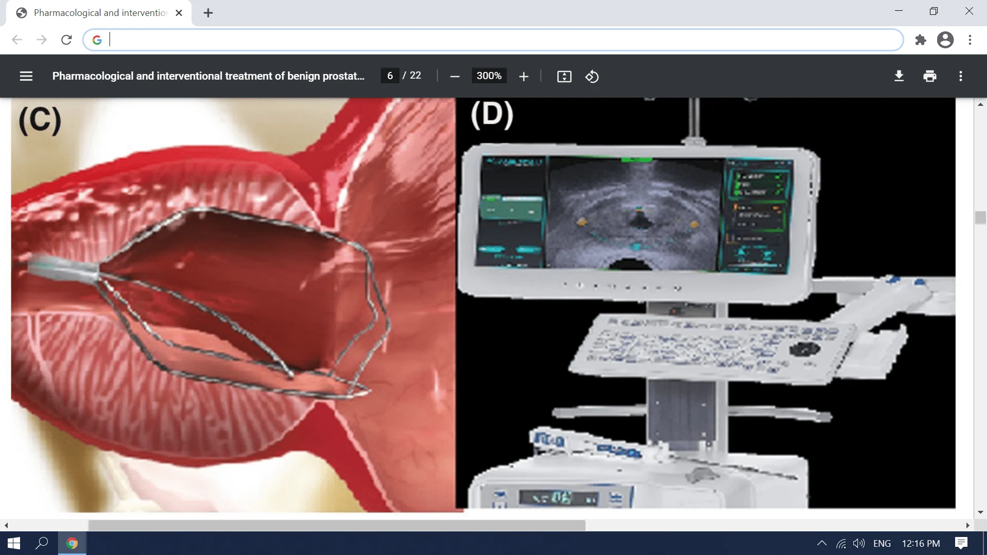 Screenshot (3403).webp