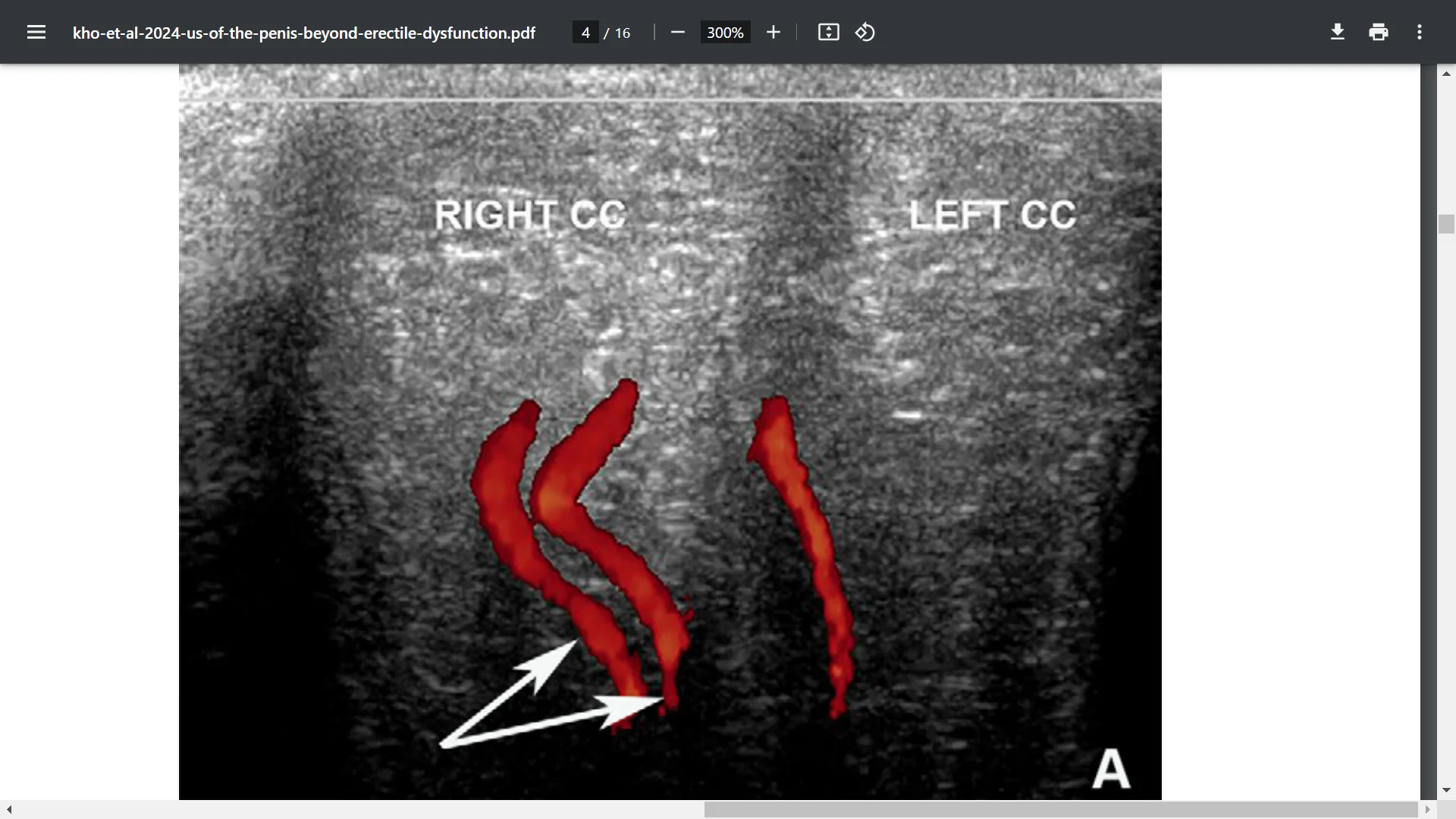 Screenshot (37511).webp