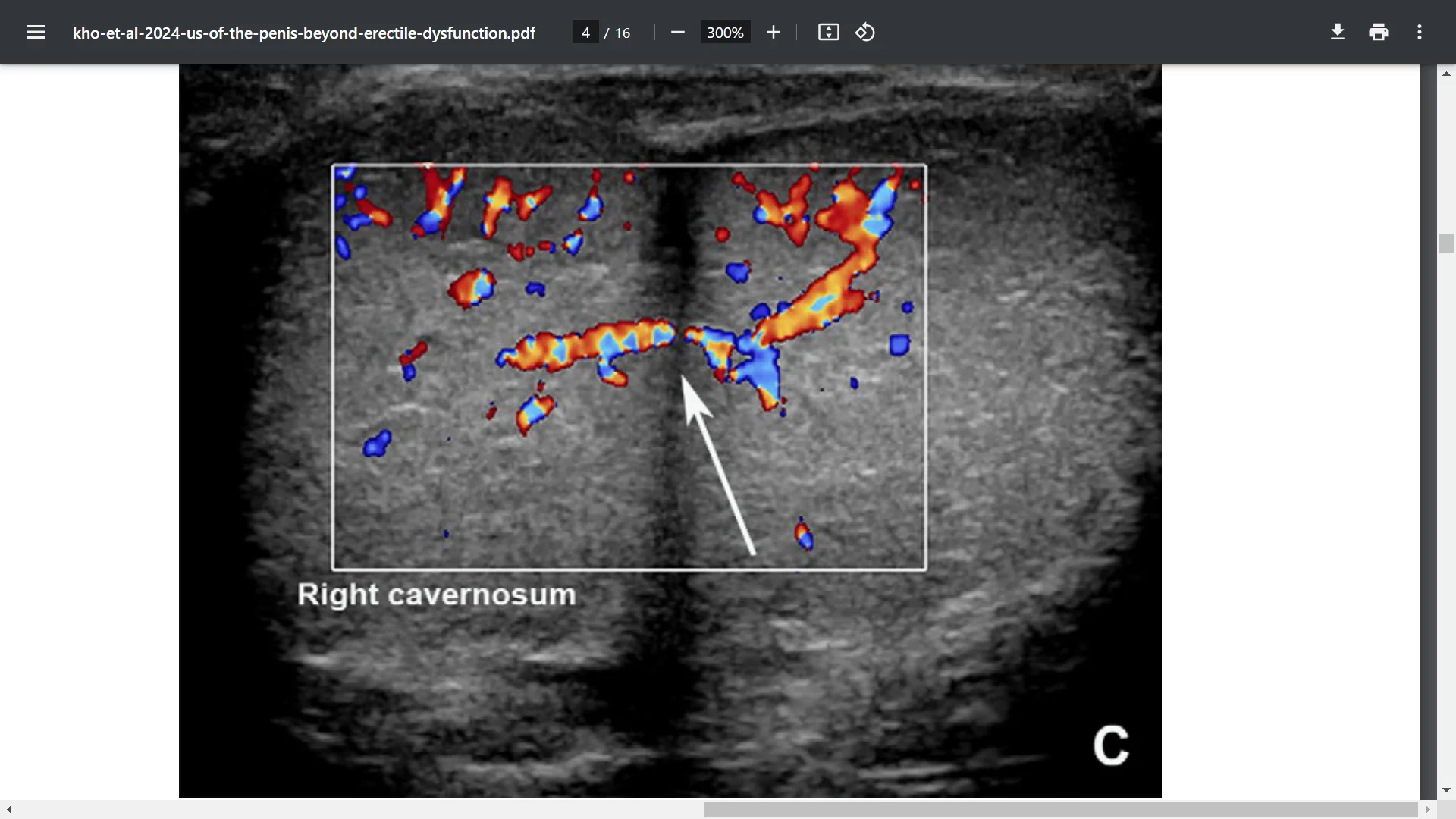 Screenshot (37513).webp