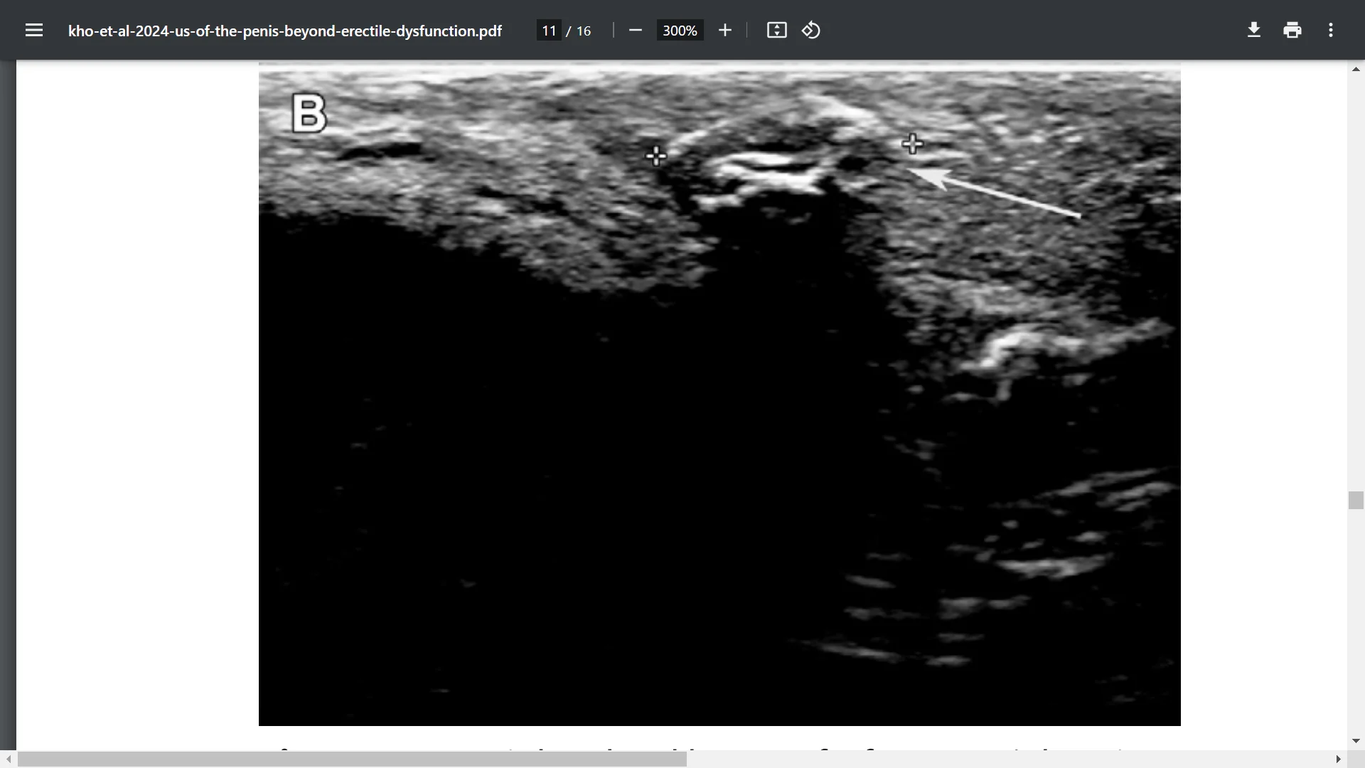 Screenshot (37529).webp
