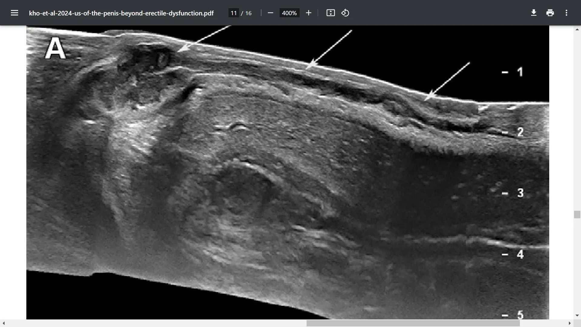 Screenshot (37530).webp