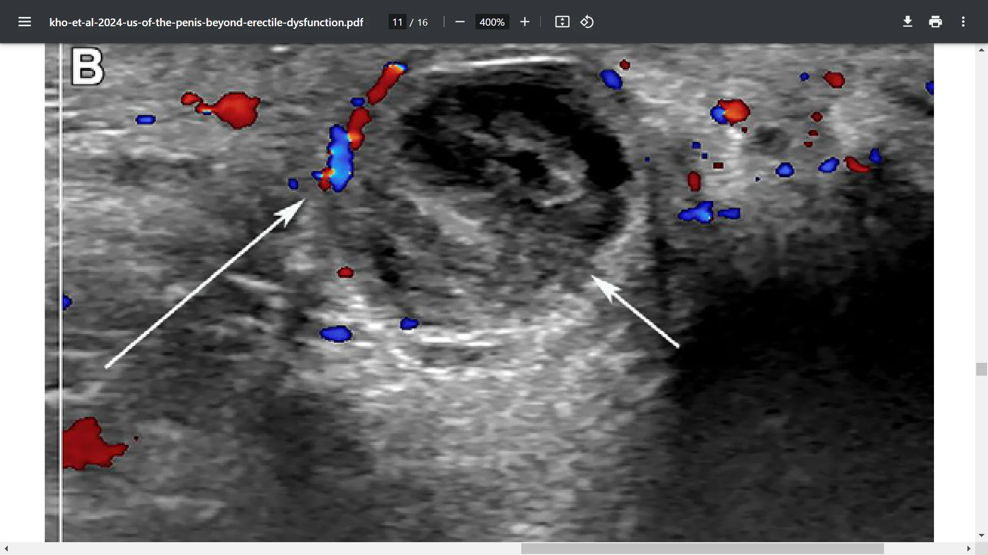 Screenshot (37531).webp