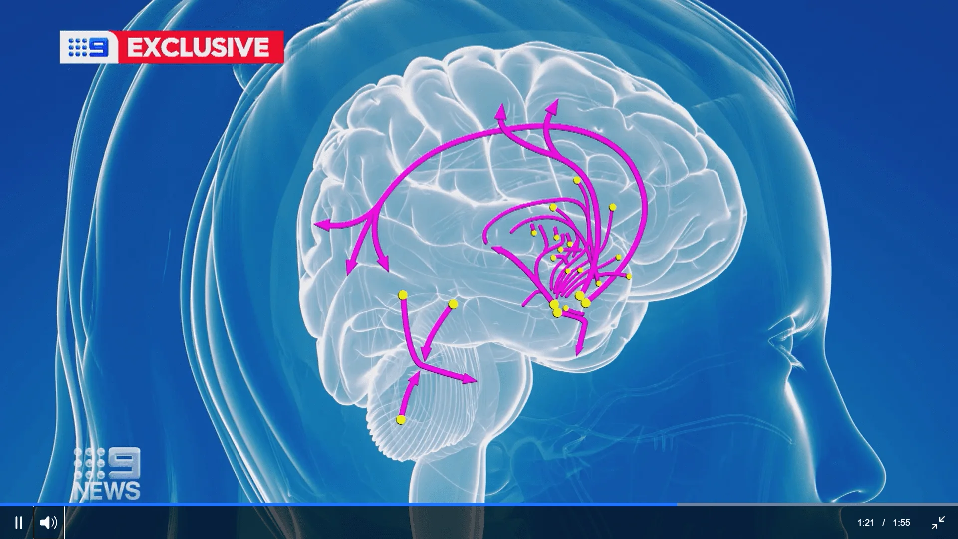 New Nasal Spray to Enhance Women's Libido Excel Male TRT Forum