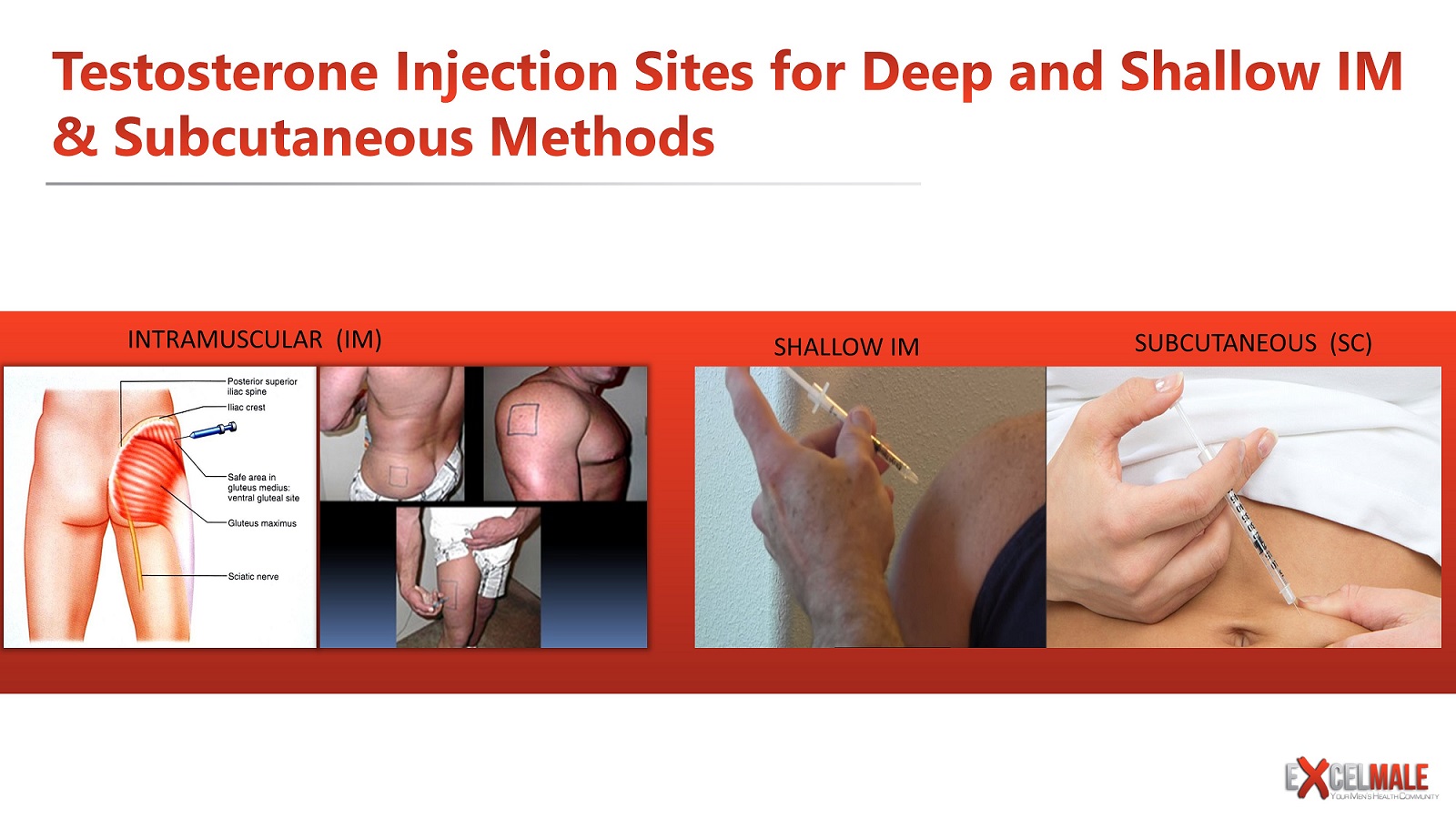 subcutaneous versus intramuscular IM testosterone injections.jpg
