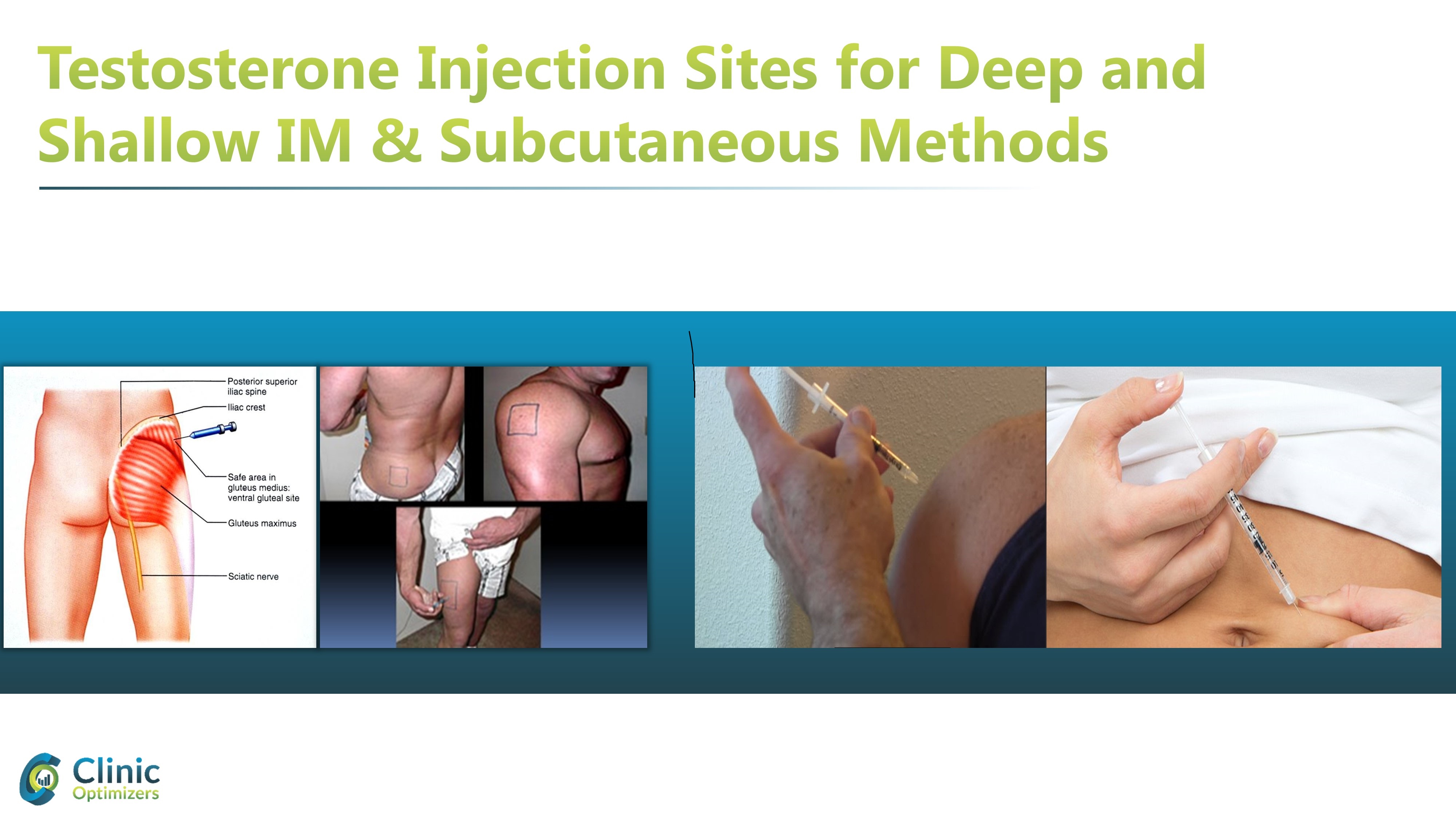 testosterone injection sites.jpg