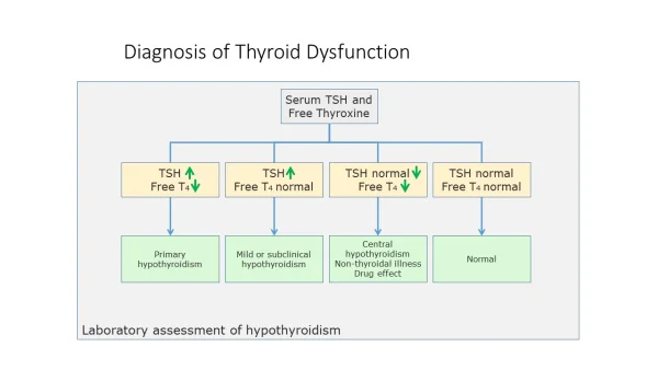 thyroid diagnosis.webp