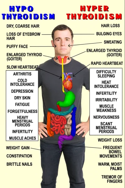 thyroid dysfunction man.webp