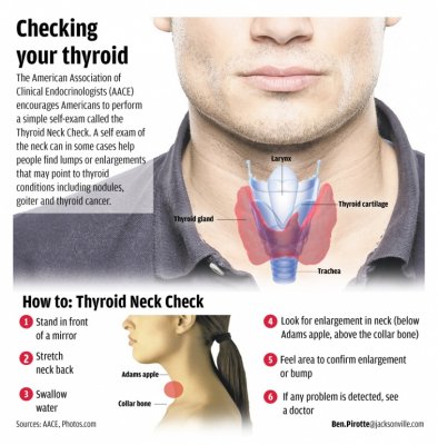 thyroid (1).jpg