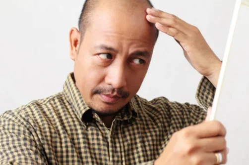 Propecia_hair_loss.webp Propecia_hair_loss.webp