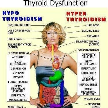 ThyroidDysfunction.jpg