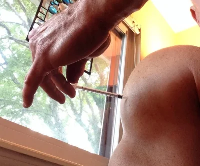 90 degree injection.webp