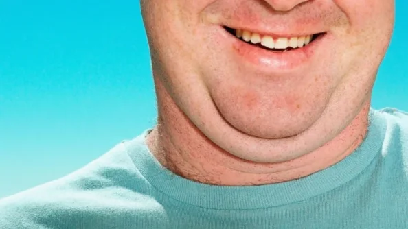 double chin drug.webp double chin drug.webp