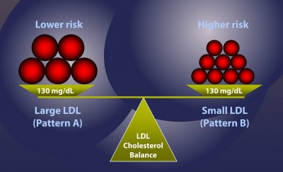 large LDL vs small LDL.jpg
