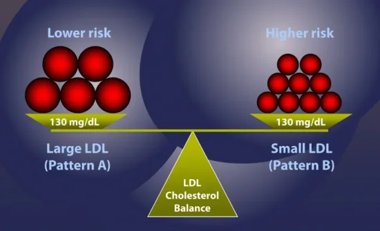 large LDL vs small LDL.jpg