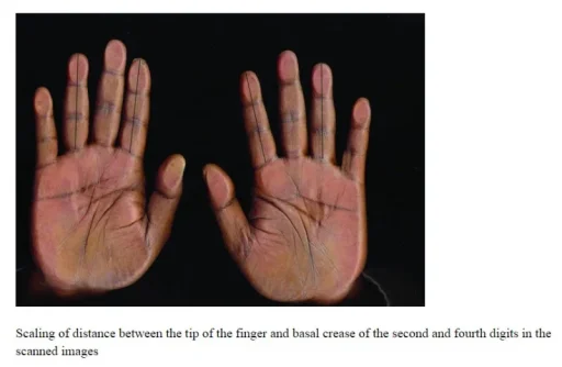 2 d 4 d finger ratio.webp 2 d 4 d finger ratio.webp
