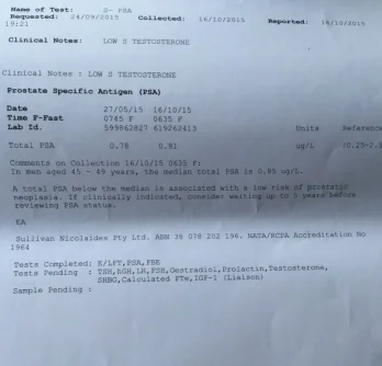 DD SPSA.webp