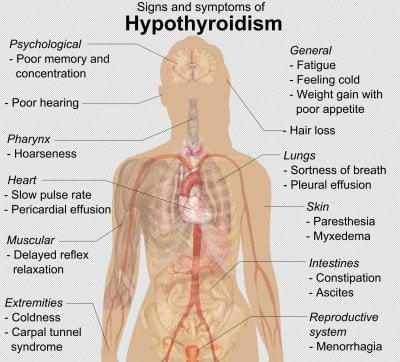Signs_and_symptoms_of_hypothyroidism.png.jpg