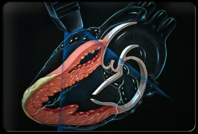 heart_disease_s13_echocardiography.jpg