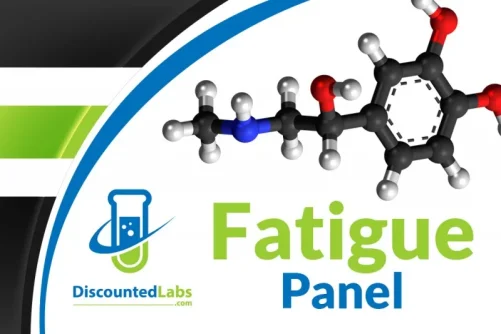 fatigue panel.webp fatigue panel.webp