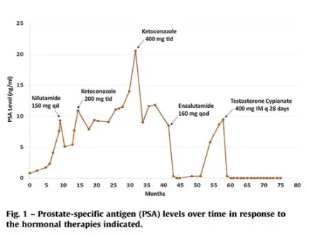 testosterone bipolar prostate.webp