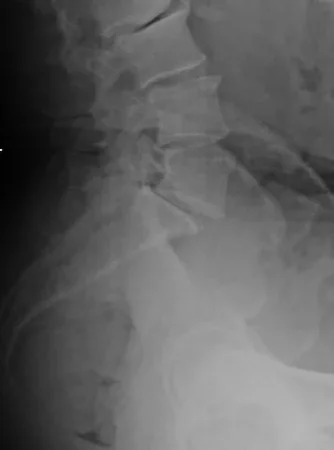spine 2.webp