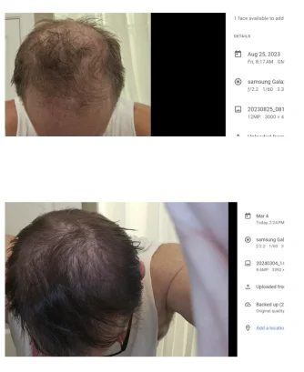 Hair 2.webp