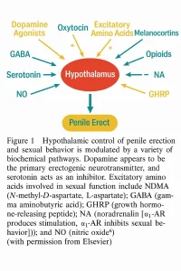 erection factors.webp