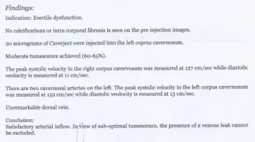 Doppler Test 1.webp