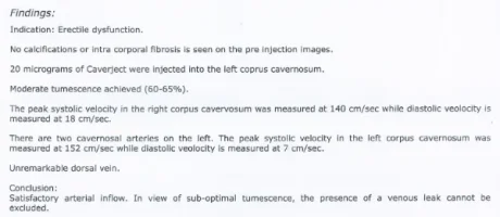 Doppler Test 2.webp