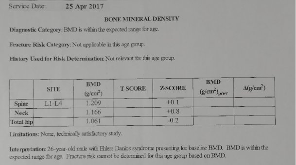Bone Density scan - April 2017.jpg