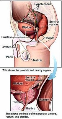 prostate.jpg
