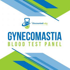 gynecomastia tests