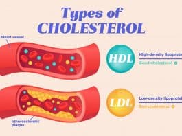 cholesterol brain