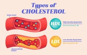 cholesterol brain
