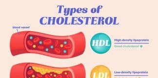 cholesterol brain