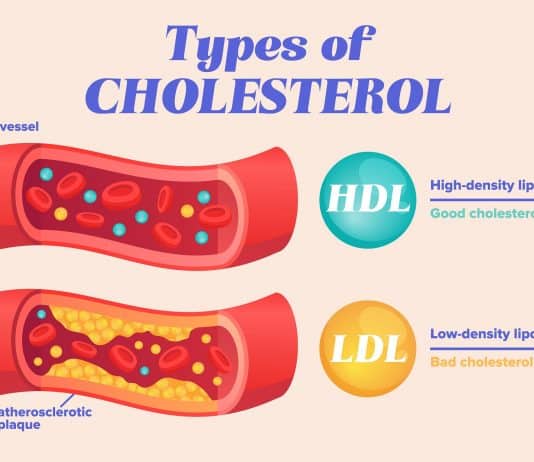 cholesterol brain