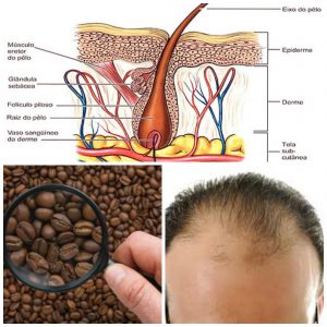 Hair Loss Excelmale
