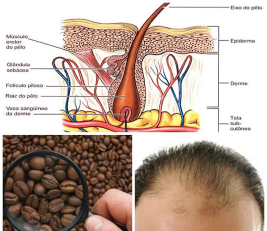 Hair Loss Excelmale