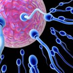 hyperspermia Male Infertility Exelmale