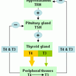 Hypothyroidism Exelmale